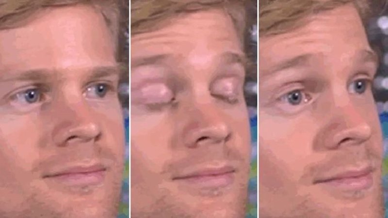 White guy blinking meme